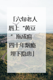 六旬老人唇上“黄豆”拖成癌 四十年烟瘾埋下隐患