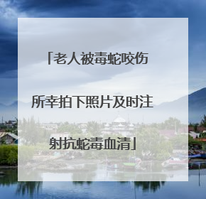 老人被毒蛇咬伤 所幸拍下照片及时注射抗蛇毒血清